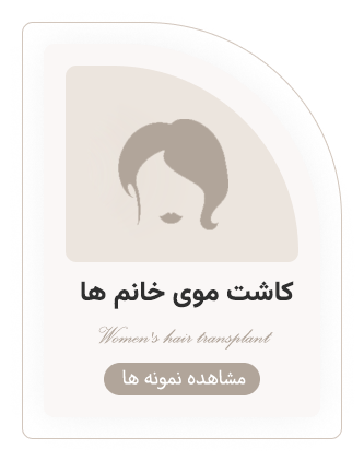 کاشت موی خانم ها