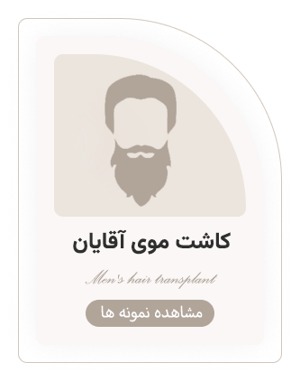 کاشت موی آقایان