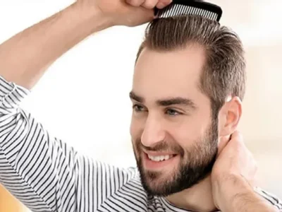 کاشت مو به روش FUE